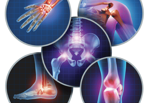 Osteoporosis bone health program