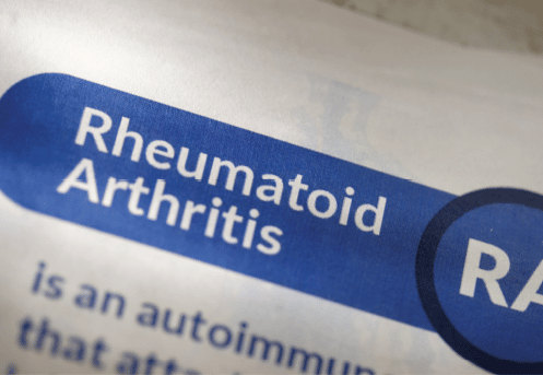 Rheumatoid arthritis joint care