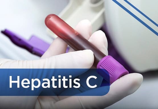 Hepatitis C virus treatment